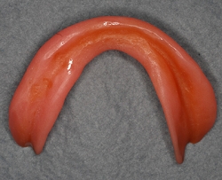 旧義歯1