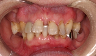 異常な歯列